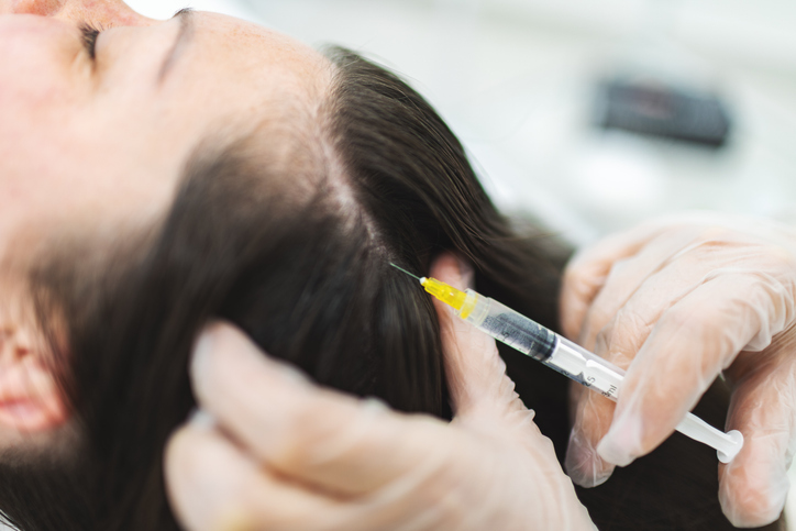 Gloved clinician injecting PRP into a woman's scalp for hair restoration treatment