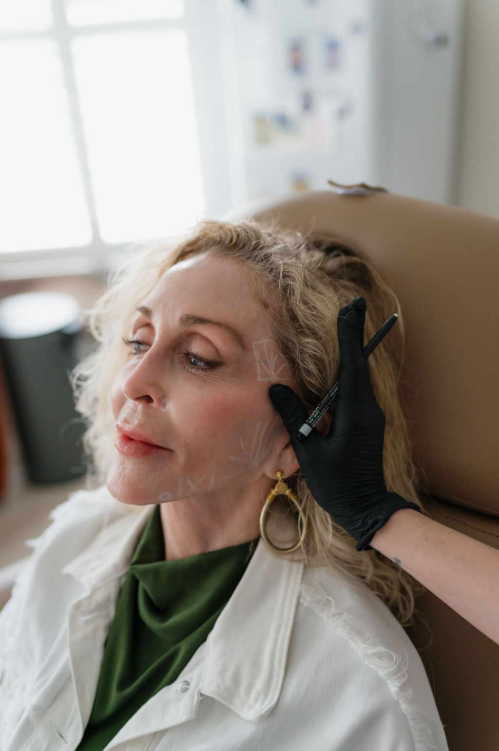 Woman receiving cosmetic consultation, practitioner in black glove marking facial areas with pencil on cheek.