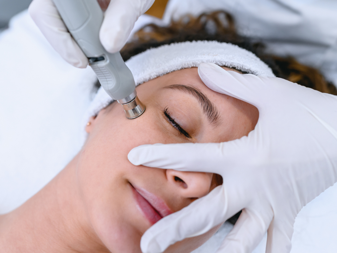 Close-up of a woman receiving microdermabrasion facial treatment with handheld device by gloved esthetician